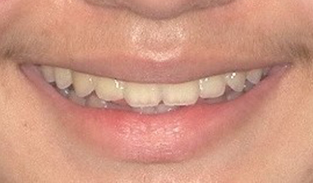 flawless teeth