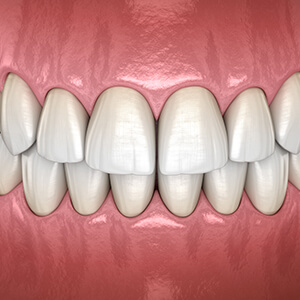 Animation of healthy teeth and gums