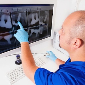Dentist looking at tooth x-rays