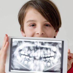 a child holding a digital X-ray of a mouth